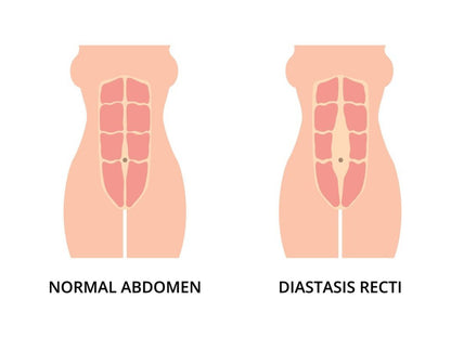 CORE REHAB TO HELP GET RID OF YOUR BELLY POOCH